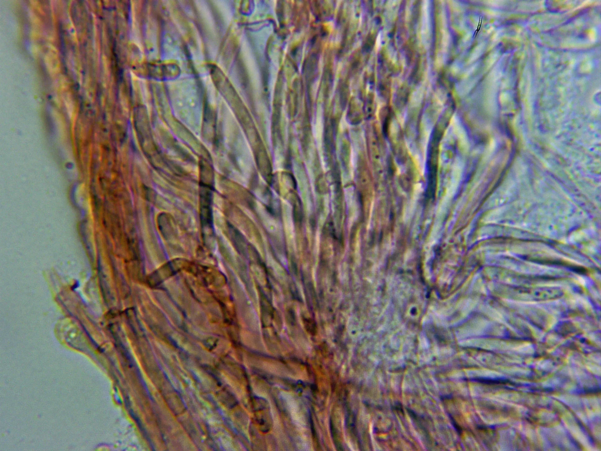Microscopía de Pterula multifida - 10 - Hifas generativas fibuladas